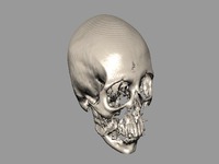volume rendering (CT head)